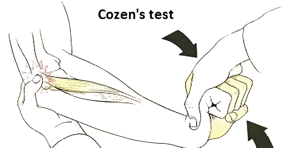 Physiotherapy Assessment